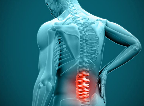 What is a herniated disc?