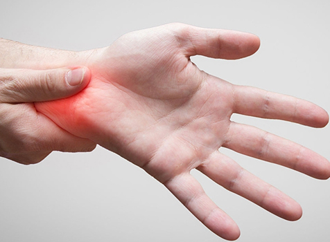 What is Carpal Tunnel Syndrome?